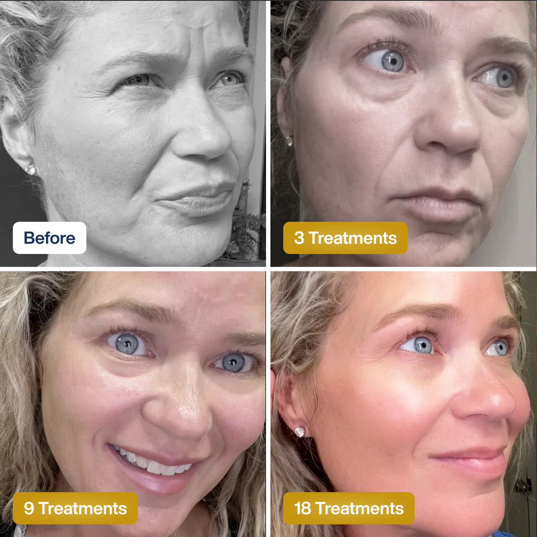 Overnight Collagen Renewal Face Mask
